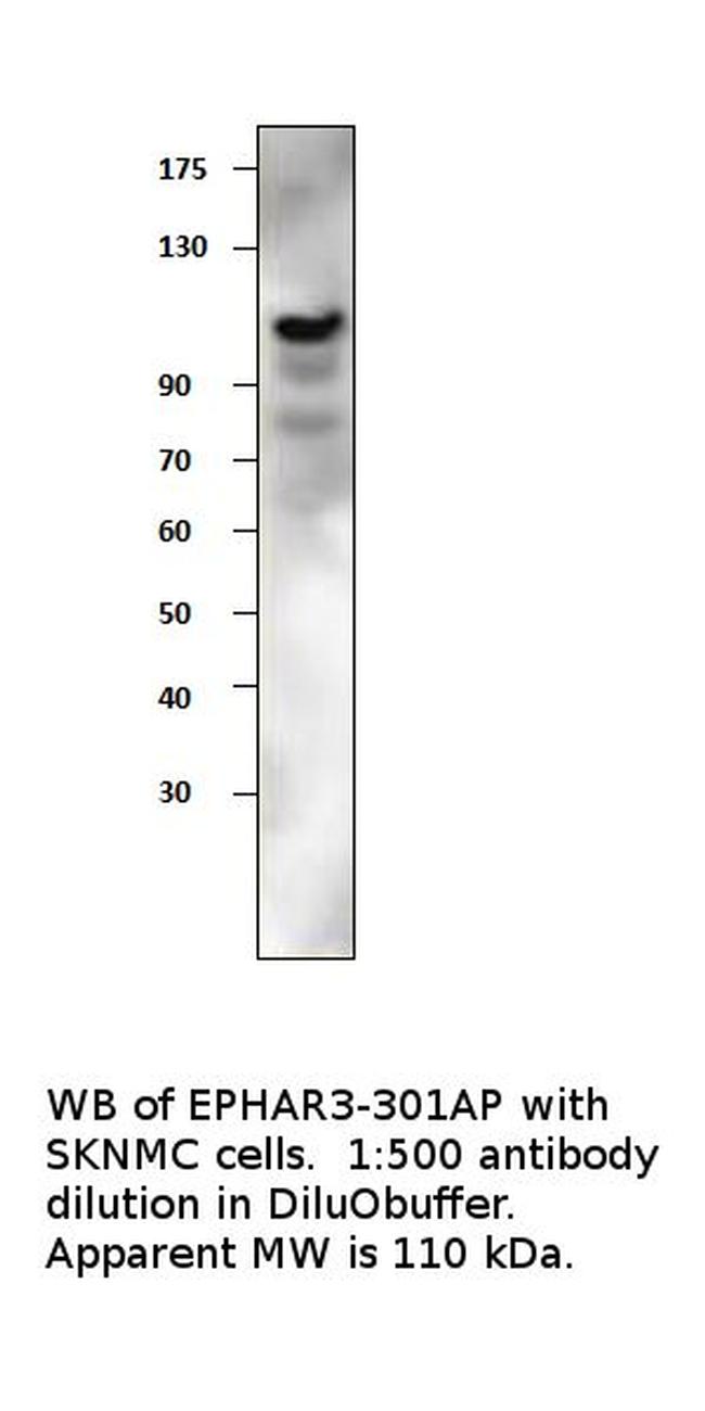 Ephrin Receptor A3 Antibody in Western Blot (WB)