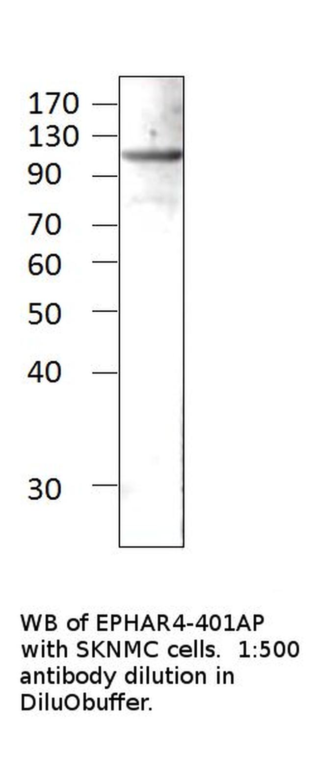 Ephrin Receptor A4 Antibody in Western Blot (WB)