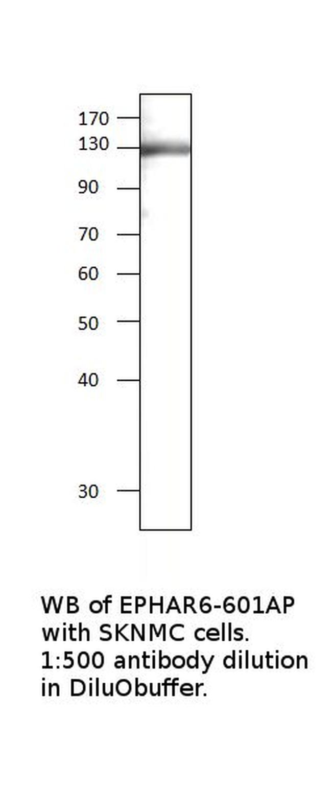 Ephrin Receptor A6 Antibody in Western Blot (WB)