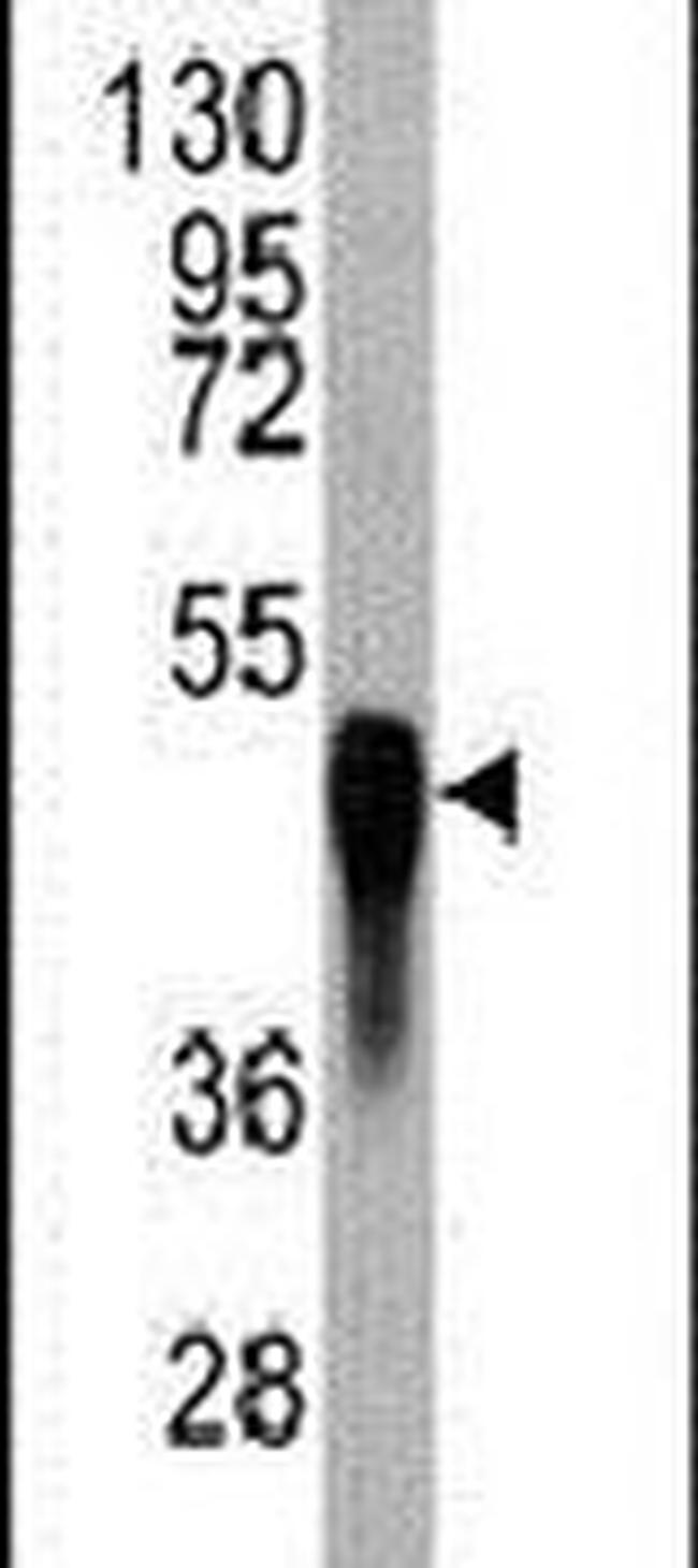 EphB4 Antibody in Western Blot (WB)