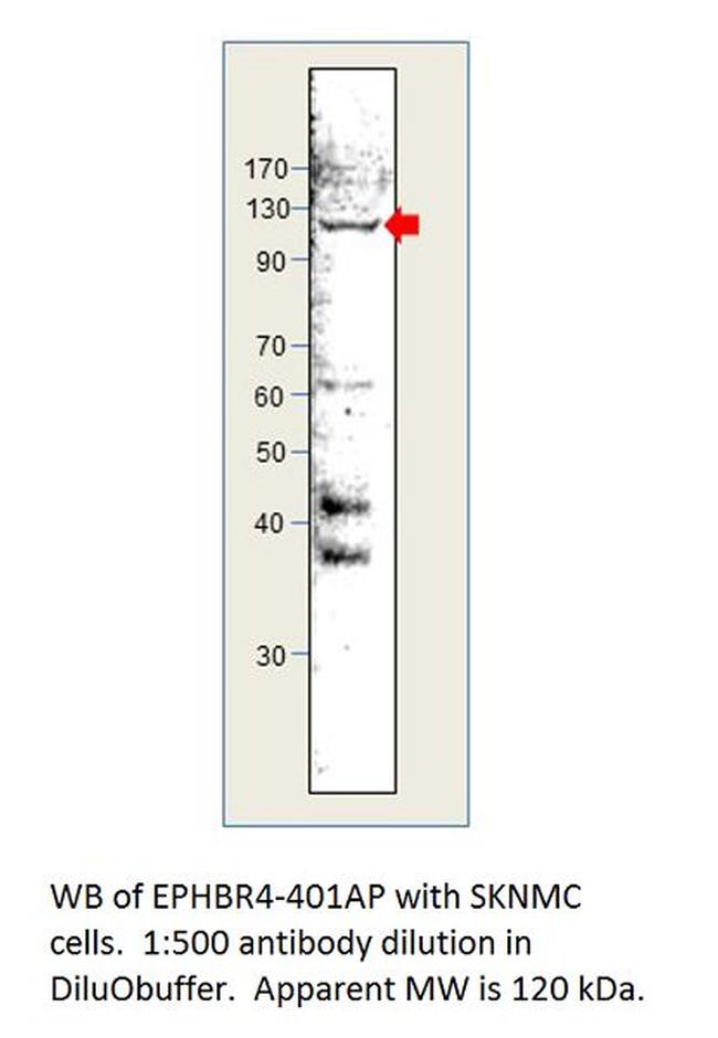 Ephrin Receptor B4 Antibody in Western Blot (WB)