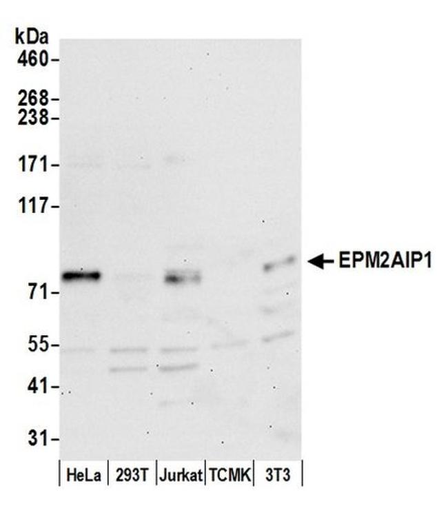 EPM2AIP1 Antibody in Western Blot (WB)