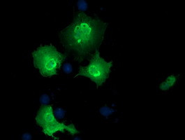 EPM2AIP1 Antibody in Immunocytochemistry (ICC/IF)