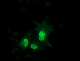 EPM2AIP1 Antibody in Immunocytochemistry (ICC/IF)