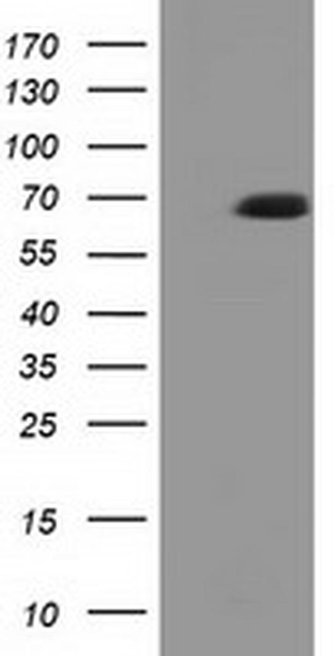EPM2AIP1 Antibody in Western Blot (WB)