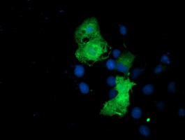 EPN2 Antibody in Immunocytochemistry (ICC/IF)
