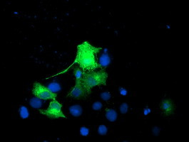 EPN2 Antibody in Immunocytochemistry (ICC/IF)