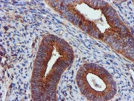 EPN2 Antibody in Immunohistochemistry (Paraffin) (IHC (P))