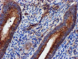 EPN2 Antibody in Immunohistochemistry (Paraffin) (IHC (P))