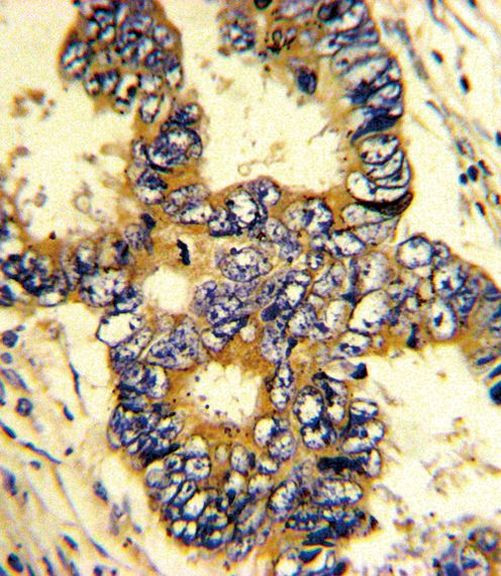Epsin 3 Antibody in Immunohistochemistry (IHC)