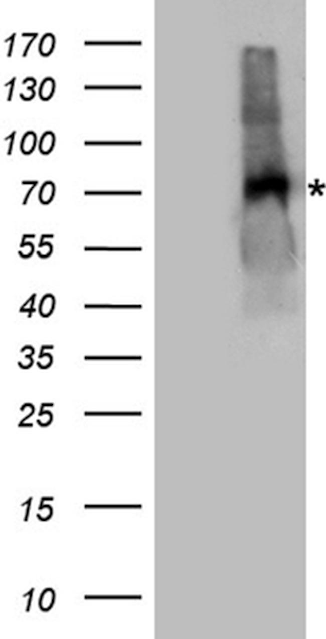 EPOR Antibody in Western Blot (WB)