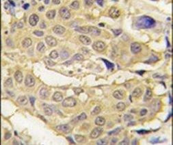 EPRS Antibody in Immunohistochemistry (IHC)