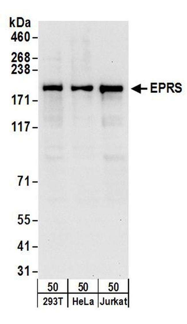 EPRS Polyclonal Antibody (A303957A)