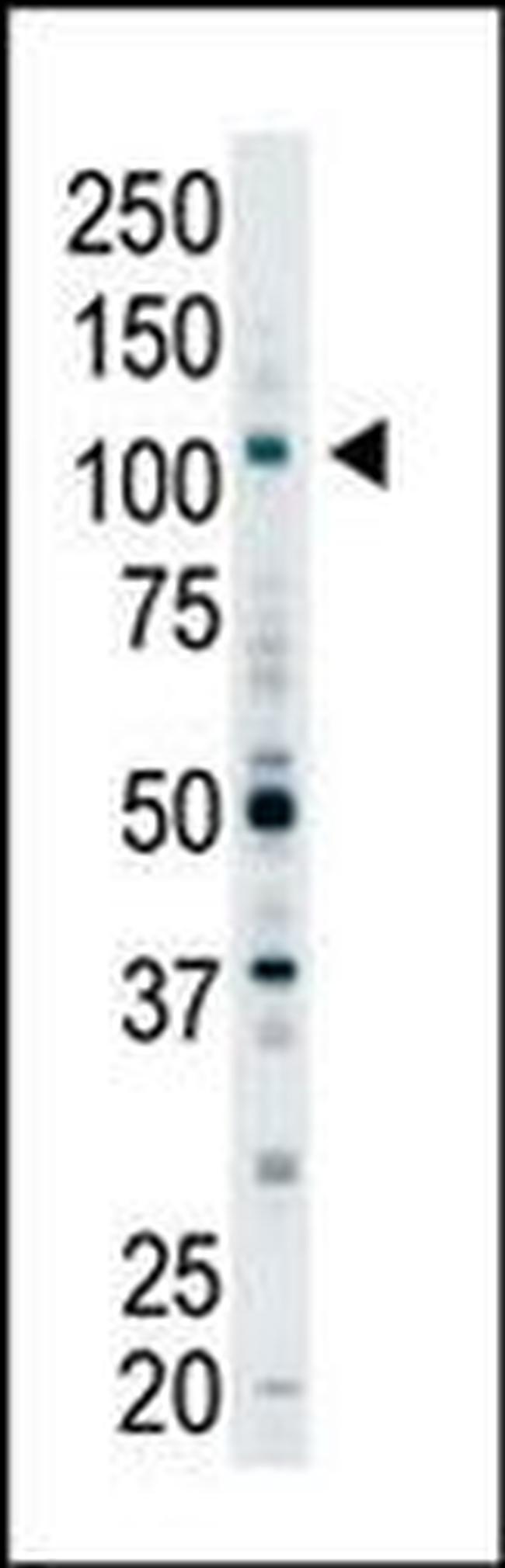 EPS15R Antibody in Western Blot (WB)