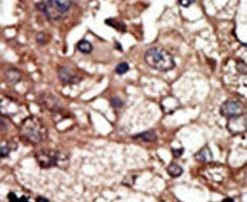 EPS8 Antibody in Immunohistochemistry (IHC)