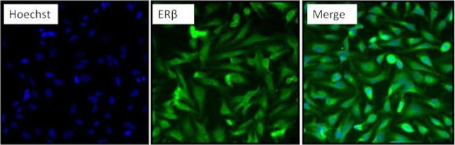 Estrogen Receptor beta Antibody in Immunocytochemistry (ICC/IF)