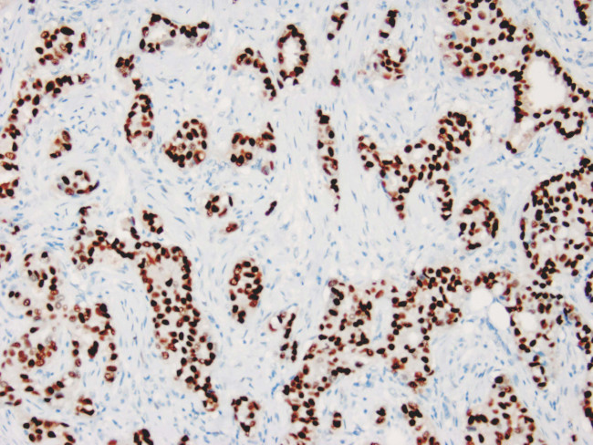 ER Antibody in Immunohistochemistry (Paraffin) (IHC (P))