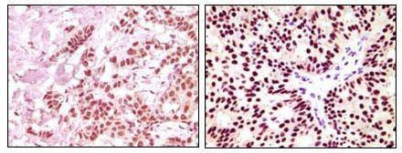 Estrogen Receptor alpha Antibody in Immunohistochemistry (Paraffin) (IHC (P))