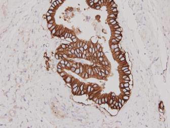 HER2/ErbB2 Antibody in Immunohistochemistry (Paraffin) (IHC (P))