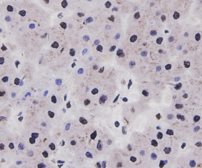 Cyclin D1 Antibody in Immunohistochemistry (Paraffin) (IHC (P))