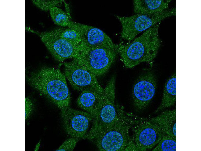 BDNF Antibody in Immunocytochemistry (ICC/IF)