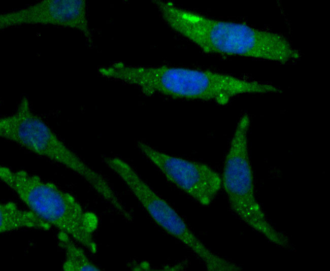 Bcl-2 Antibody in Immunocytochemistry (ICC/IF)