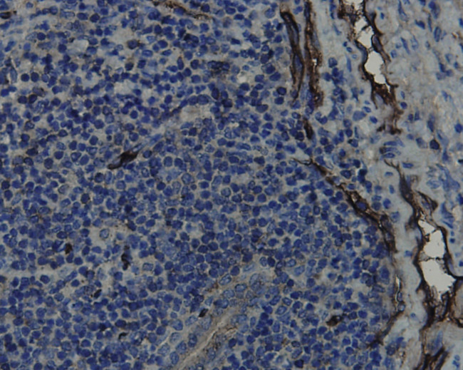 CD34 Antibody in Immunohistochemistry (Paraffin) (IHC (P))