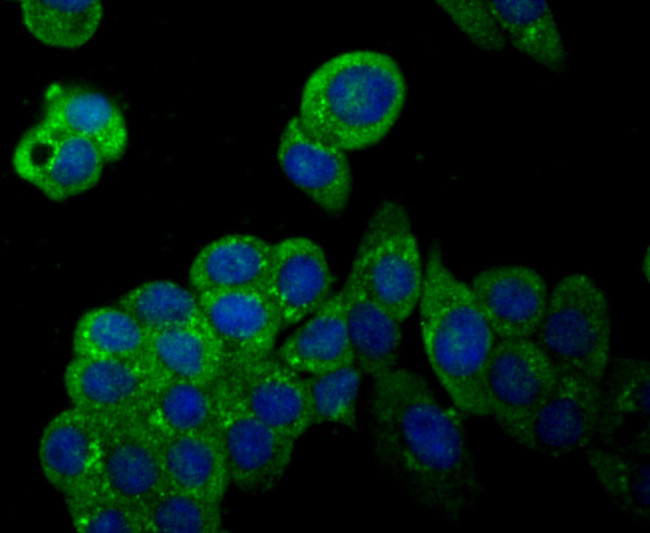Ibd Inos iNOS Polyclonal Antibody | Invitrogen (ER1706-89)