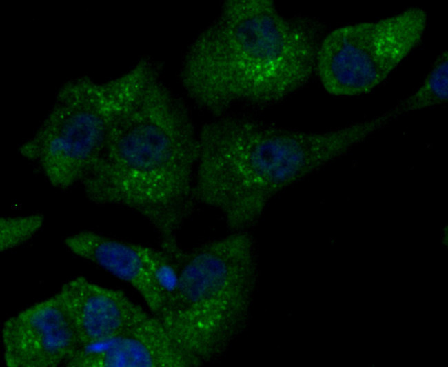 iNOS Antibody in Immunocytochemistry (ICC/IF)