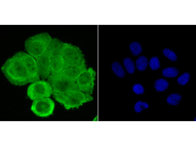 Progesterone Receptor Antibody in Immunocytochemistry (ICC/IF)
