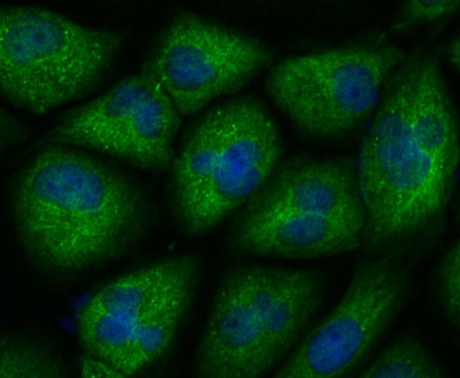 CXCR4 Antibody in Immunocytochemistry (ICC/IF)