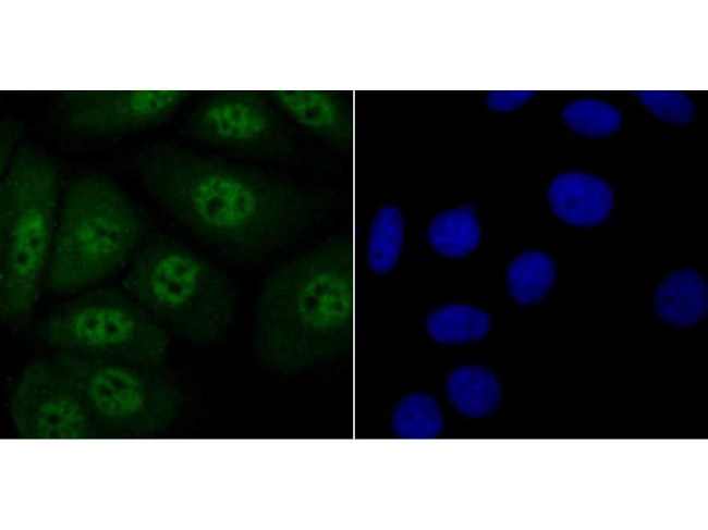 Progesterone Receptor Antibody in Immunocytochemistry (ICC/IF)