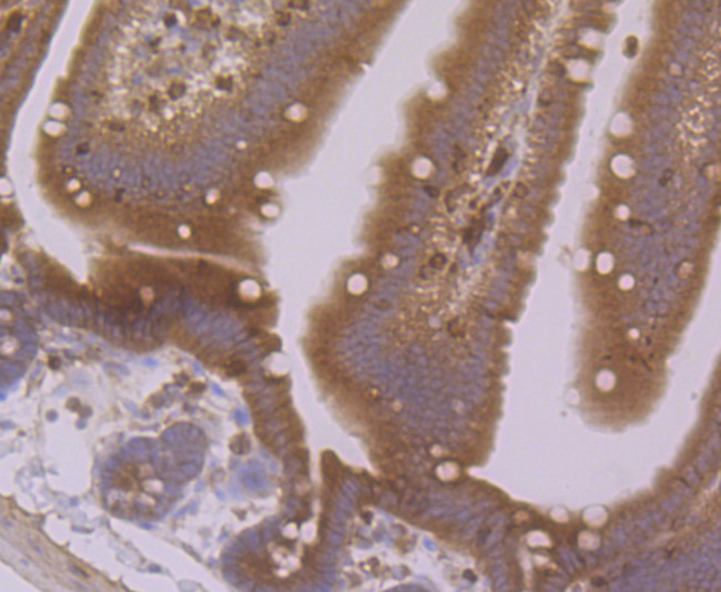 EpCAM Antibody in Immunohistochemistry (Paraffin) (IHC (P))
