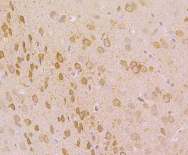 IP3 Receptor Antibody in Immunohistochemistry (Paraffin) (IHC (P))