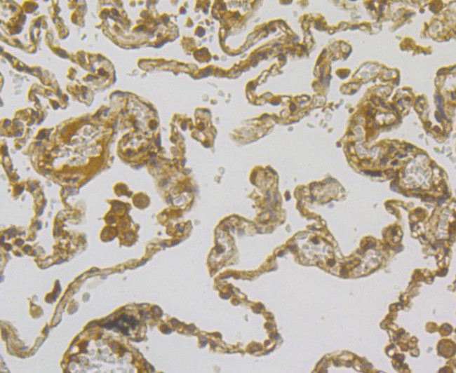 Mesothelin Antibody in Immunohistochemistry (Paraffin) (IHC (P))