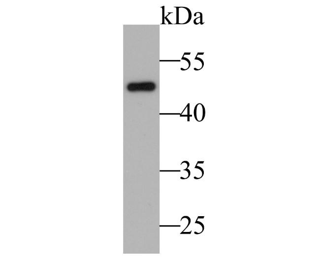 Cytokeratin 17 Antibody in Western Blot (WB)