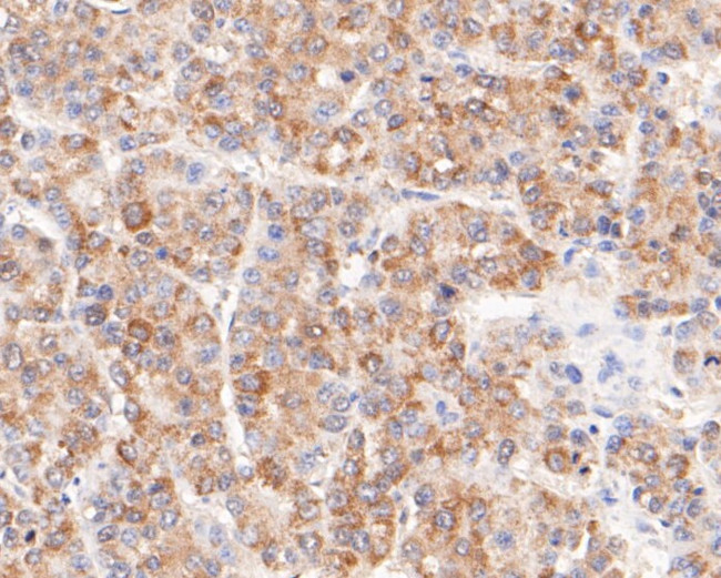 FH Antibody in Immunohistochemistry (Paraffin) (IHC (P))