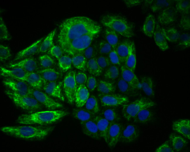 Cytokeratin 17 Antibody in Immunocytochemistry (ICC/IF)