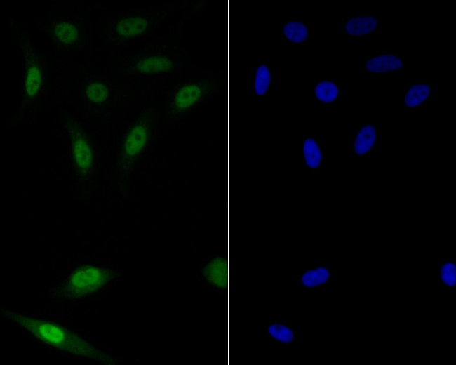 GATA3 Antibody in Immunocytochemistry (ICC/IF)