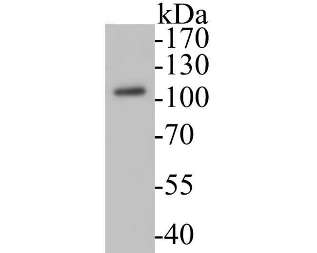 Villin1 Antibody in Western Blot (WB)