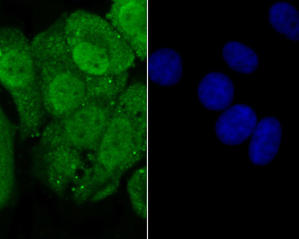Progesterone receptor Antibody in Immunocytochemistry (ICC/IF)
