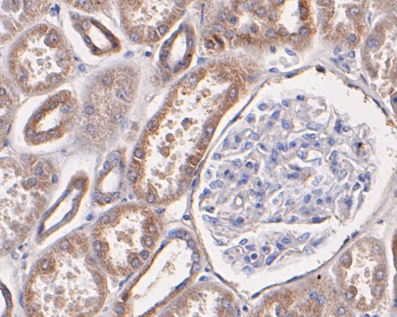 P2X7 Antibody in Immunohistochemistry (Paraffin) (IHC (P))