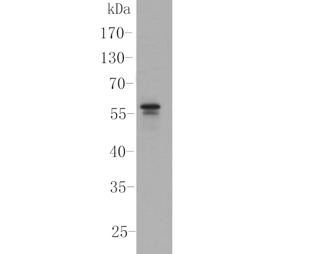PPAR delta Antibody in Western Blot (WB)