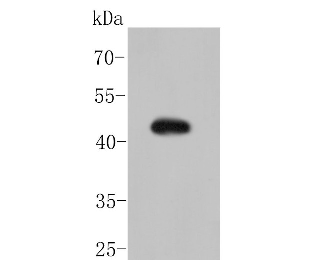 MSR1 Antibody in Western Blot (WB)