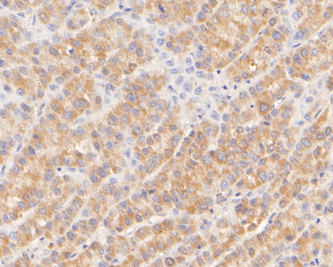 CPEB1 Antibody in Immunohistochemistry (Paraffin) (IHC (P))