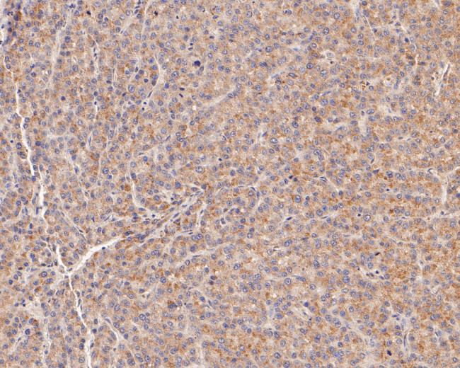 MFF Antibody in Immunohistochemistry (Paraffin) (IHC (P))