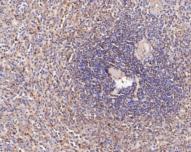CD180 Antibody in Immunohistochemistry (Paraffin) (IHC (P))