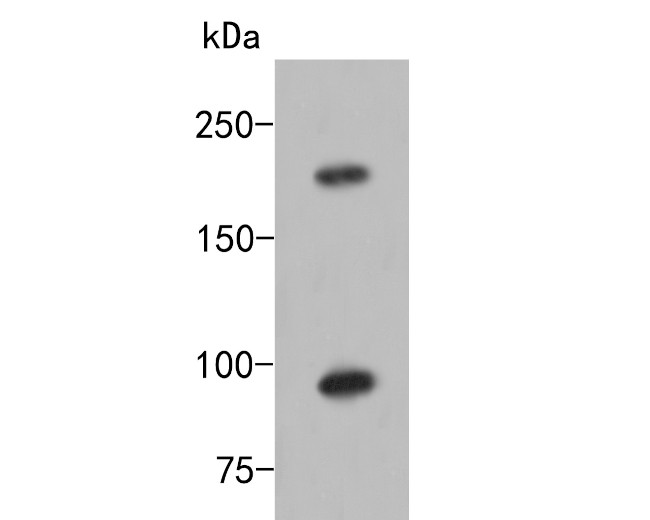 Terminal uridylyltransferase 4 Antibody in Western Blot (WB)