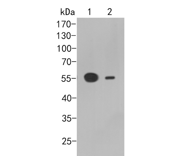 FCGRT Antibody in Western Blot (WB)