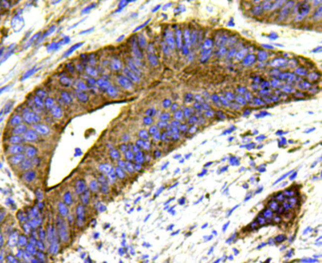 MMP1 Antibody in Immunohistochemistry (Paraffin) (IHC (P))